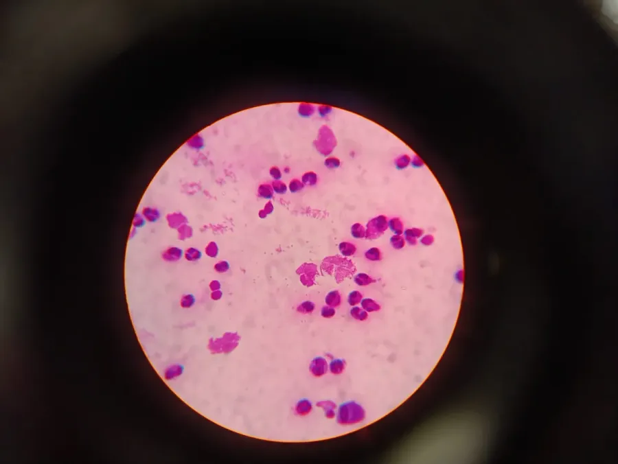 Working image from Badavet’s in-house laboratory: a stained sample seen under the microscope