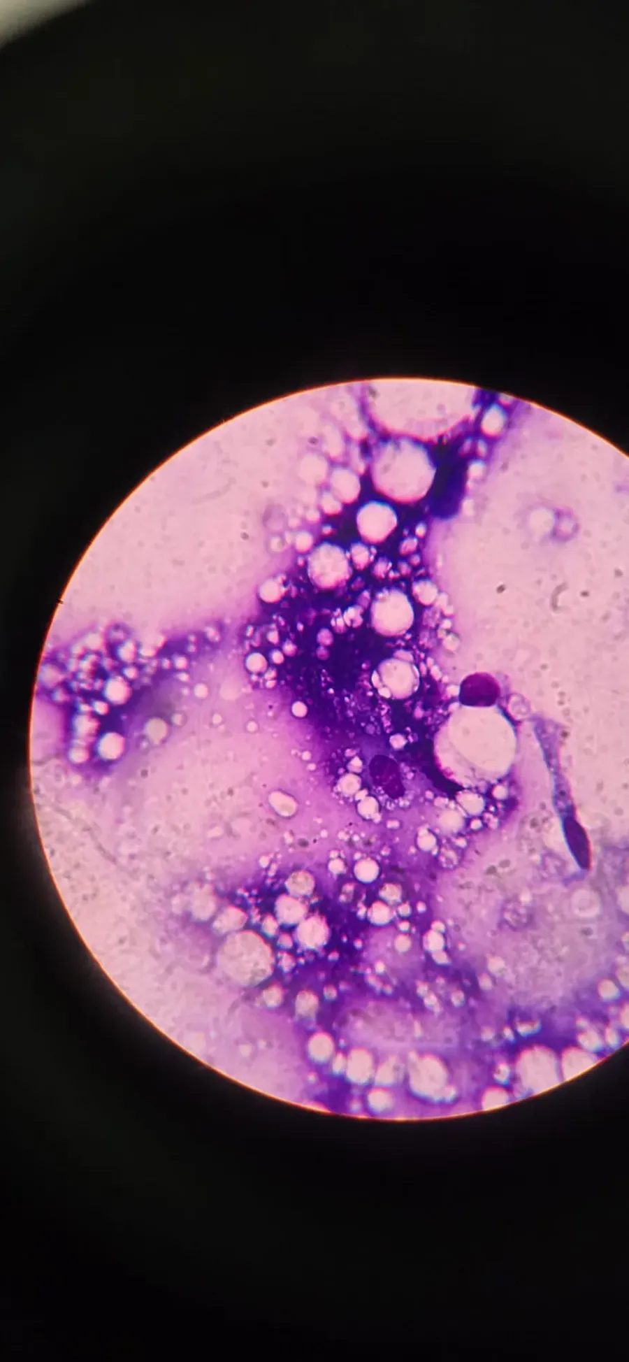 Otra muestra teñida observada al microscopio en el laboratorio interno de Badavet